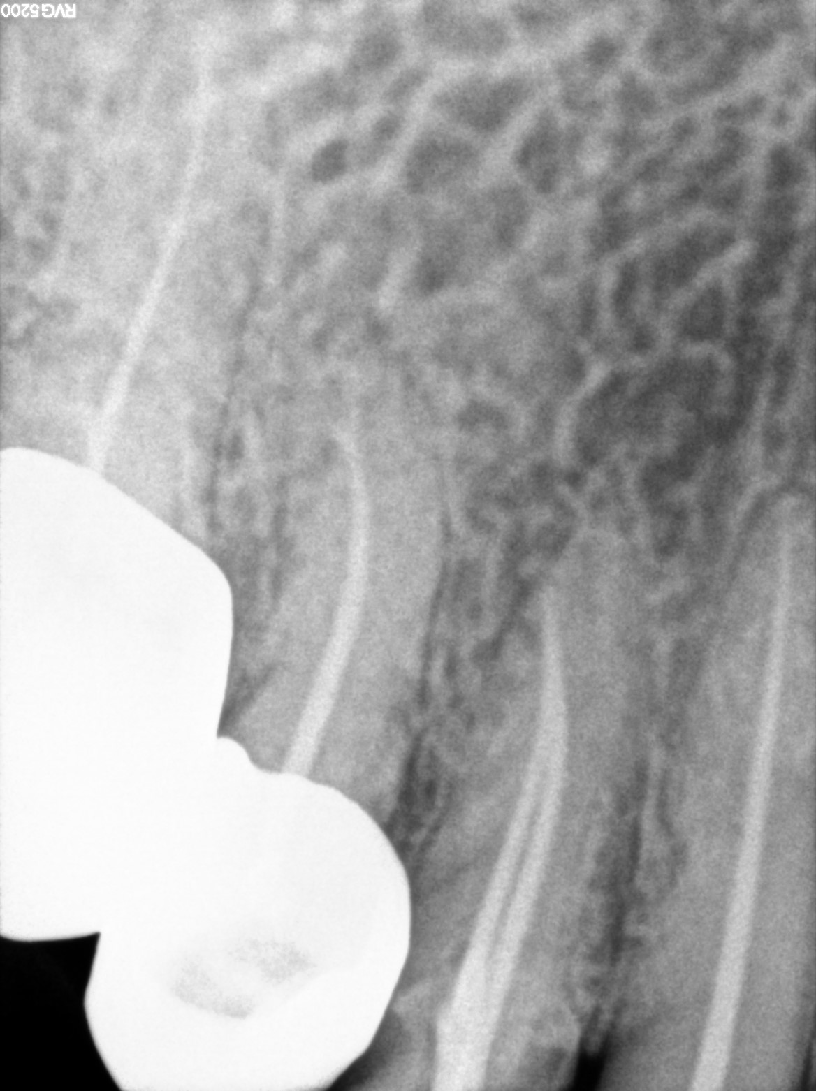 Dental X-ray